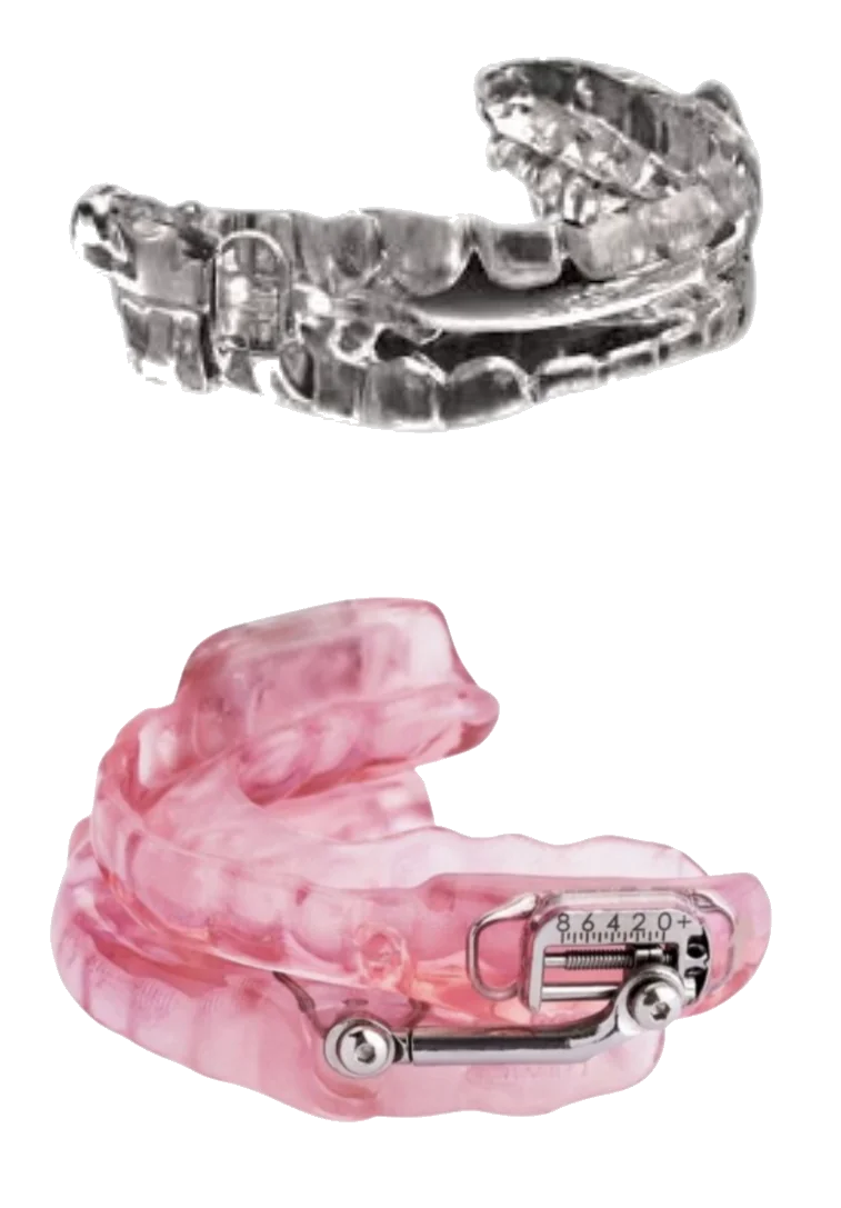Custom oral appliances for sleep apnea treatment